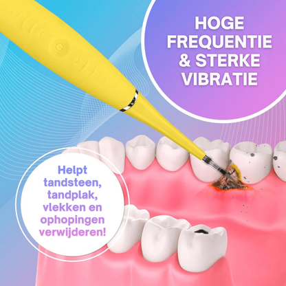 BrightEase | Ultrasone Tandereiniger