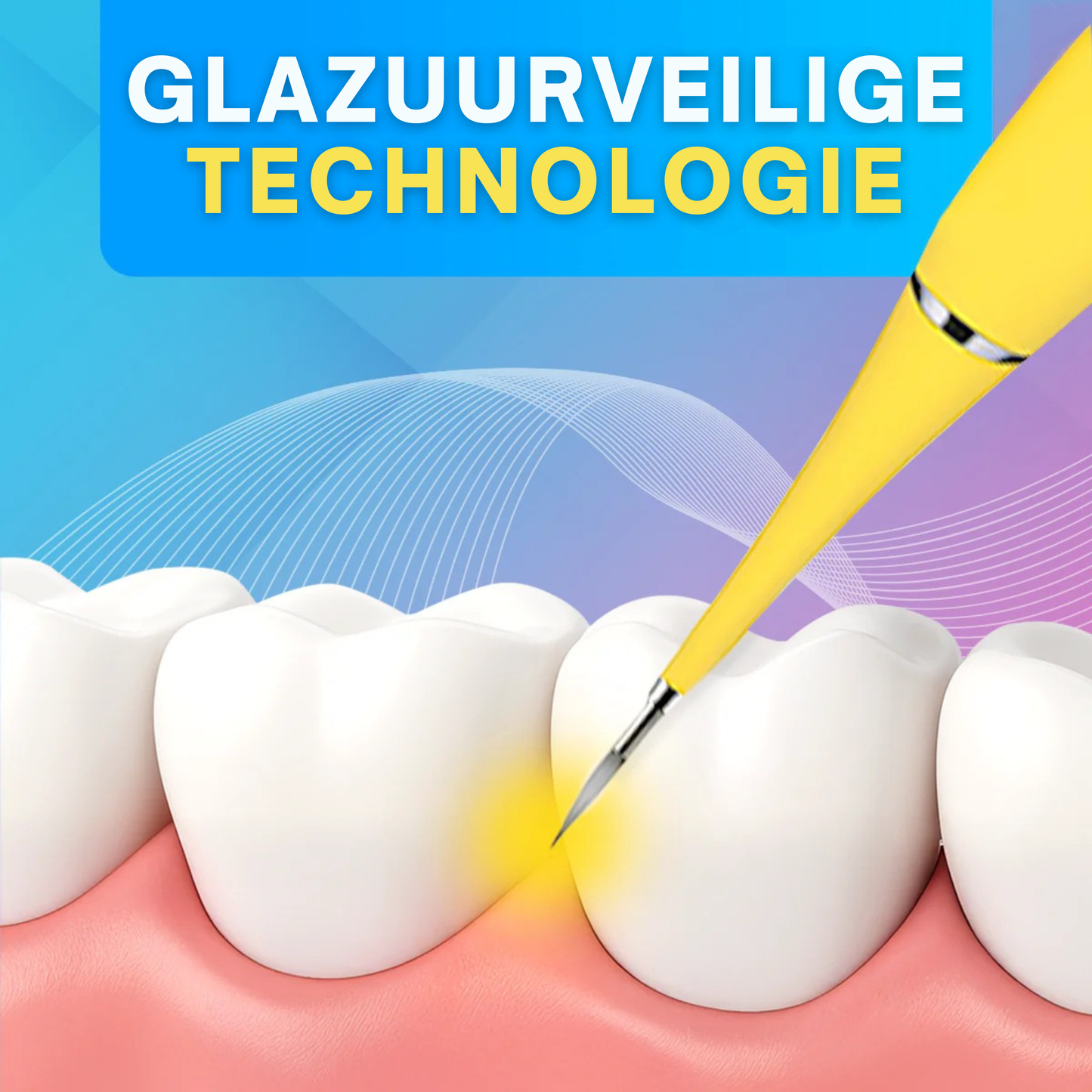 BrightEase | Ultrasone Tandereiniger