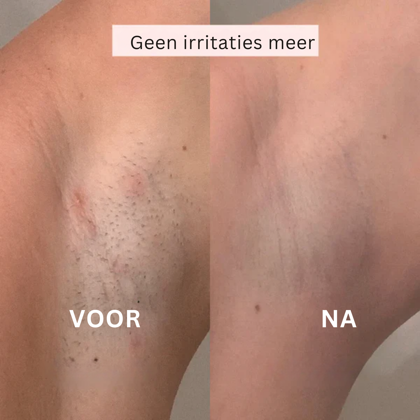 Oscire 2‑in‑1 Rasoir & Trimmer