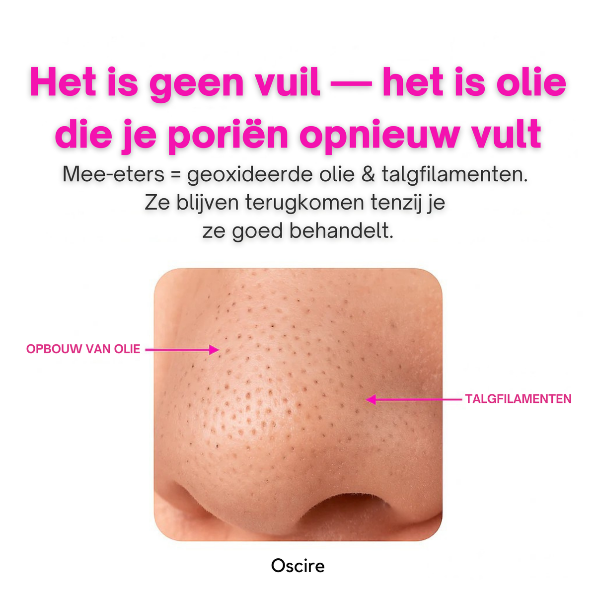 PoreLift | Makkelijk Mee-Eters Verwijderen