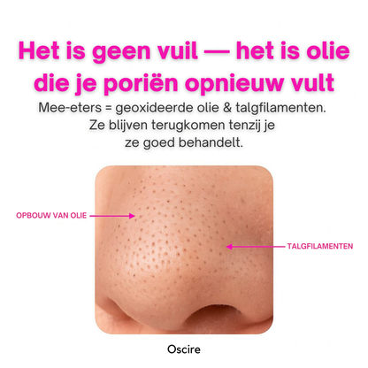 PoreLift | Makkelijk Mee-Eters Verwijderen