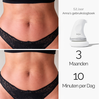 SlimTone | Klinische bodysculpting-systeem