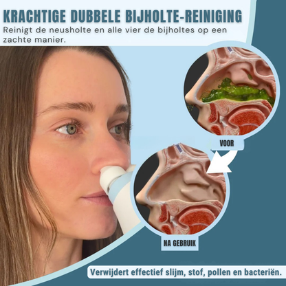 ClearAir Nasale Reinigingssysteem met Dual-Action Technologie voor Snellere Neusdoorstroming
