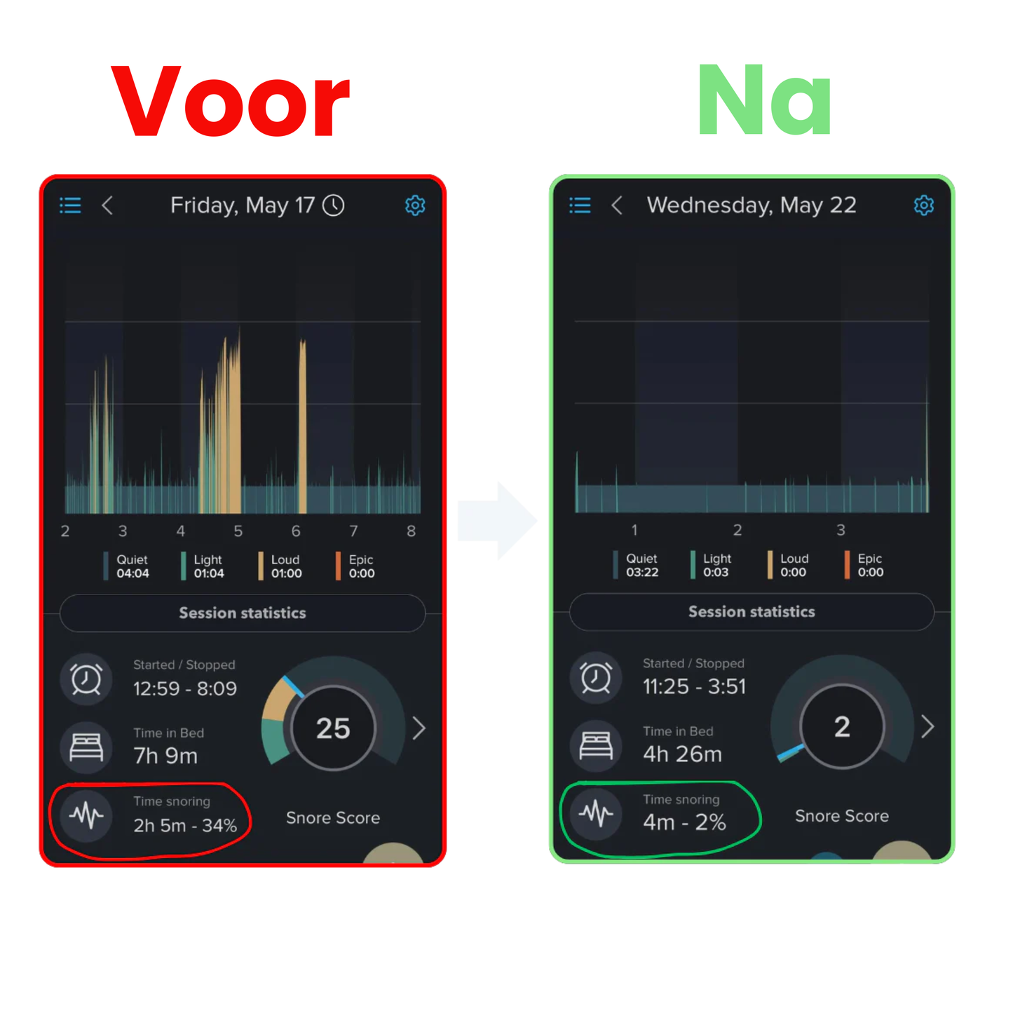 SnoreGrip Pro – Direct Snurkverlichting