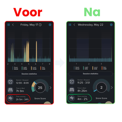 SnoreGrip Pro – Direct Snurkverlichting