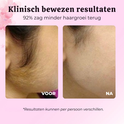 BelleBotanique | Natuurlijke, Langdurige Haarvermindering