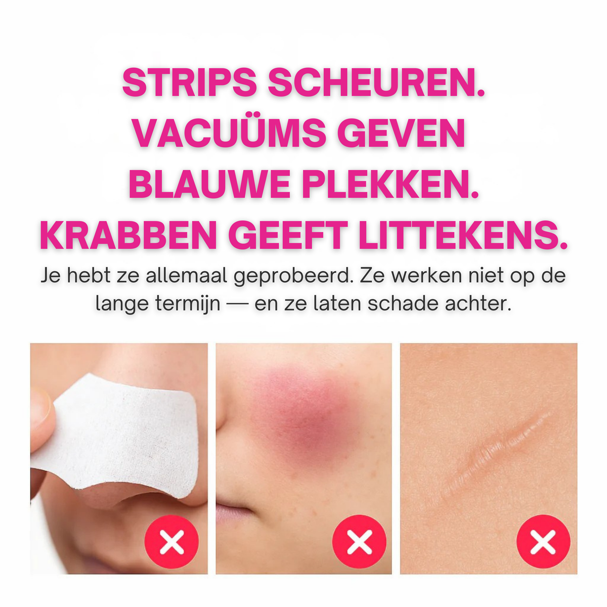 PoreLift | Makkelijk Mee-Eters Verwijderen