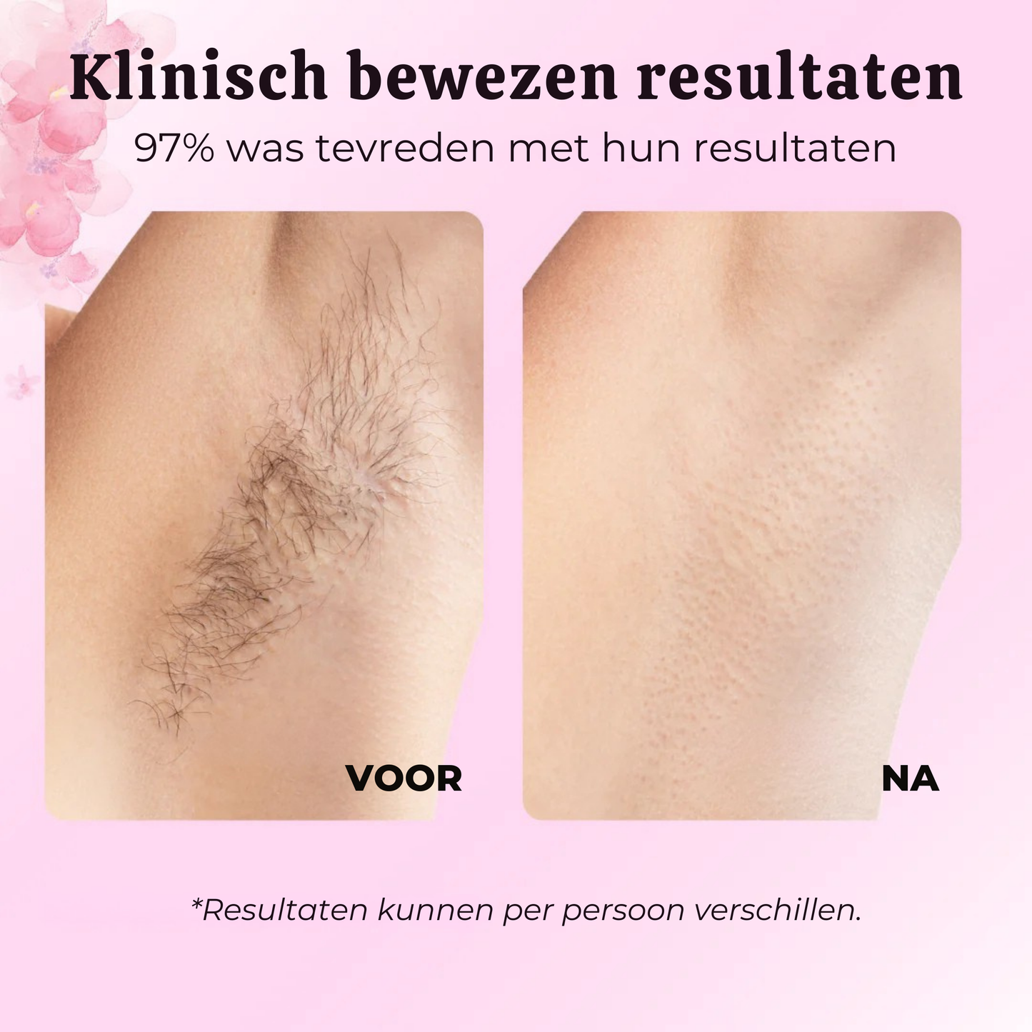 BelleBotanique | Natuurlijke, Langdurige Haarvermindering