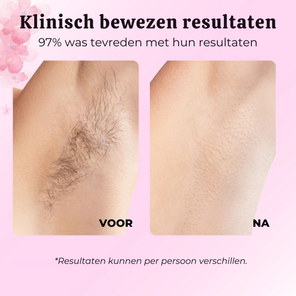 BelleBotanique | Natuurlijke, Langdurige Haarvermindering