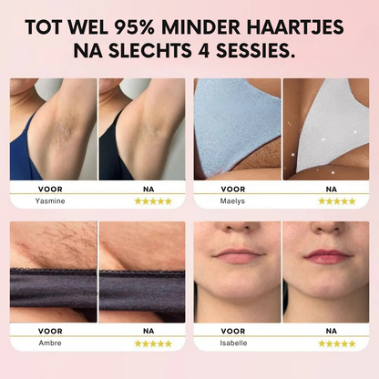 IPL Pulse - Epilator met gepulseerd licht