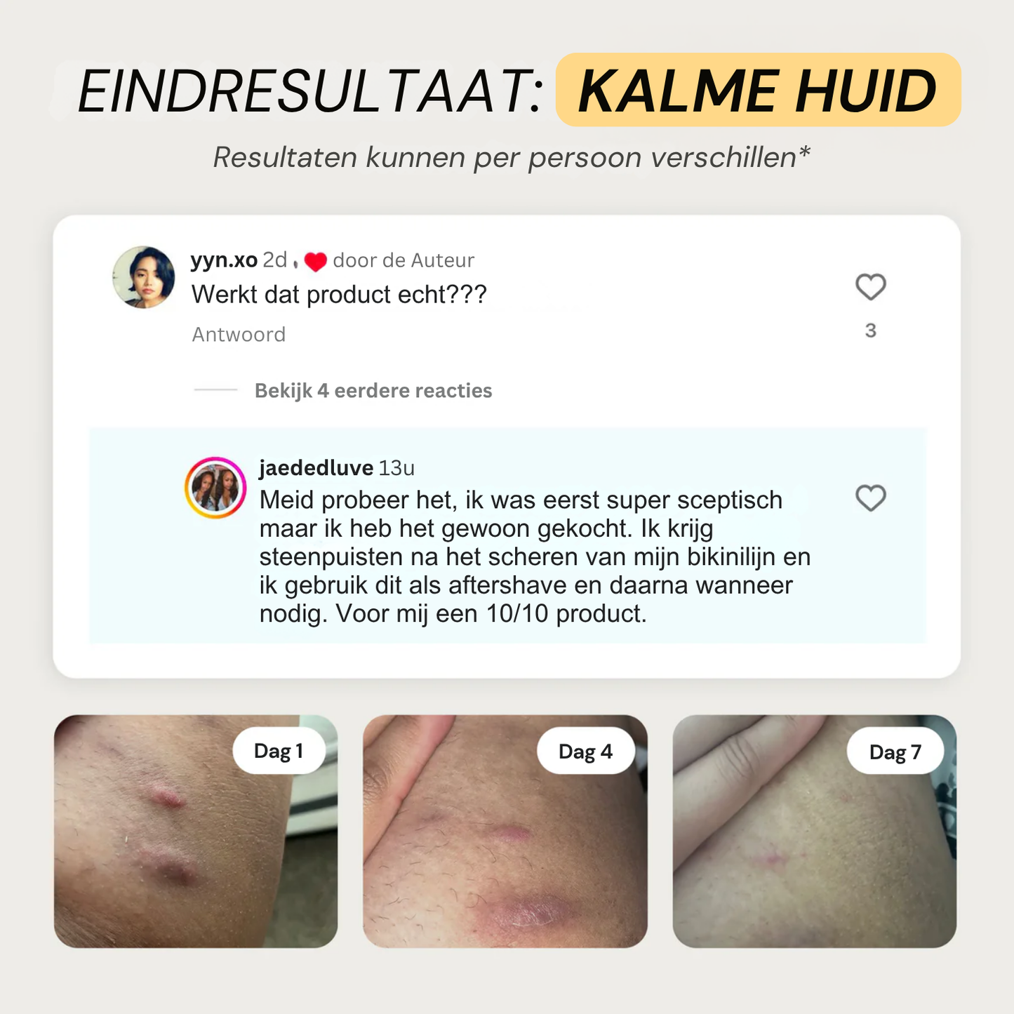 DermaCalm | Kalmerende Herstellende Huidbalsem