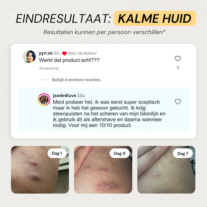 DermaCalm | Kalmerende Herstellende Huidbalsem