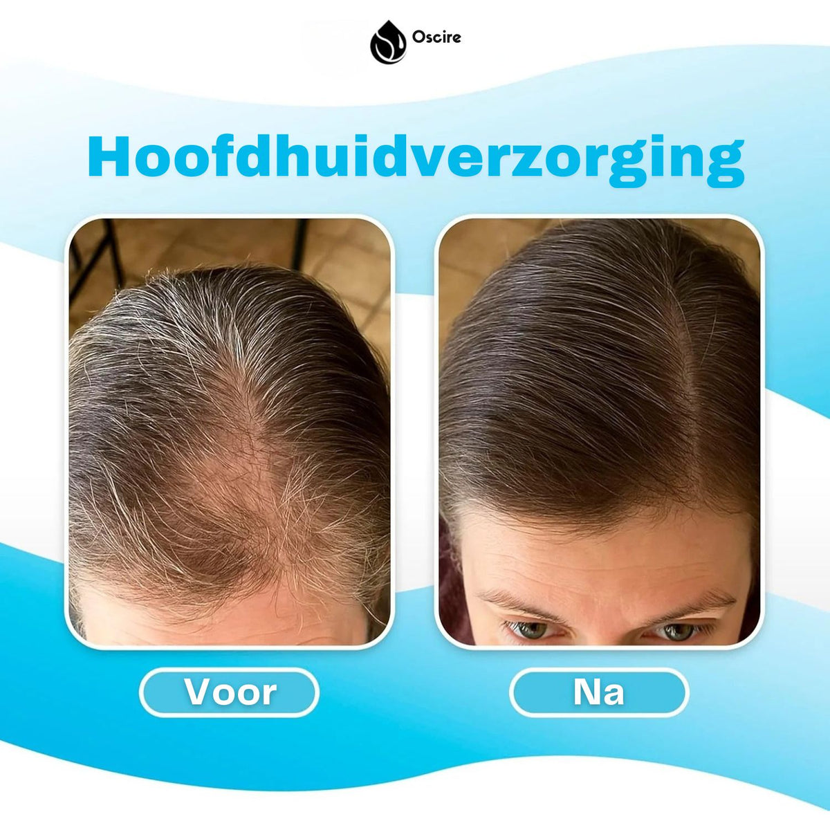 AquaPulse Ionic Pro Douchekop met Drukversterking en Minerale Filtertechnologie