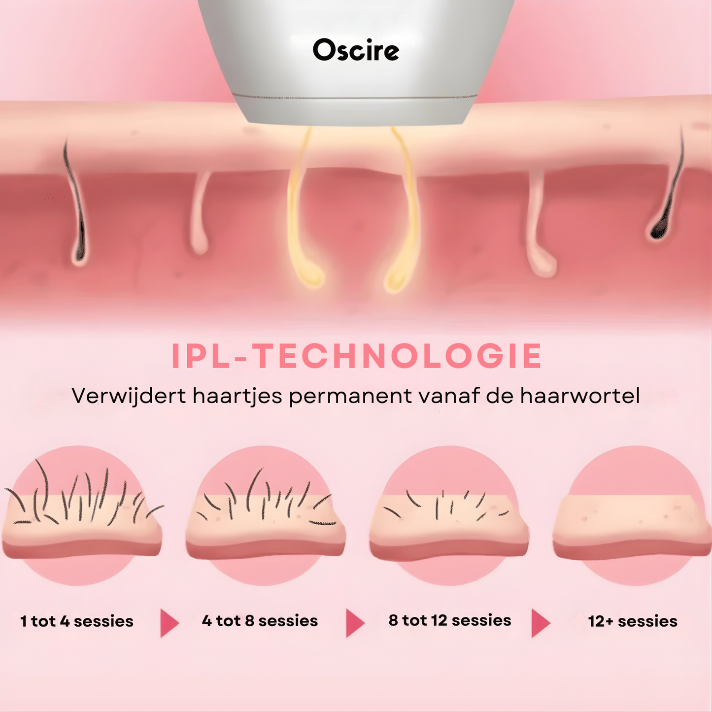 IPL Pulse - Epilator met gepulseerd licht