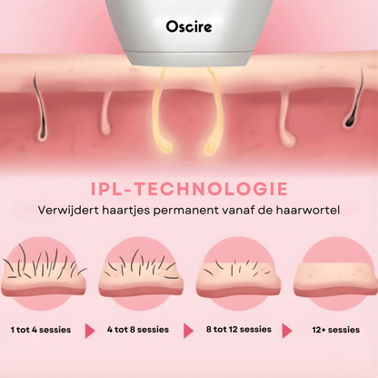 IPL Pulse - Epilator met gepulseerd licht