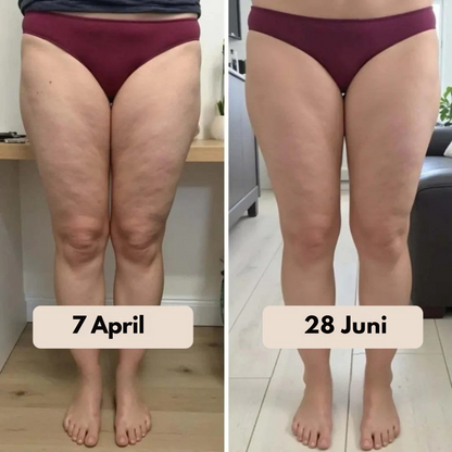 3D Legging – Verstevig je silhouet en verminder zichtbaar cellulite