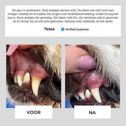 Dental Vingerdoekjes | Veilige & Gezonde Gebitsverzorging