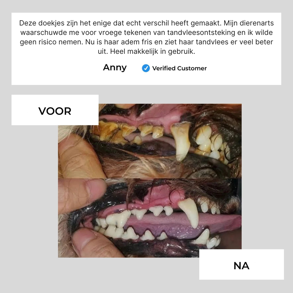 Dental Vingerdoekjes | Veilige & Gezonde Gebitsverzorging