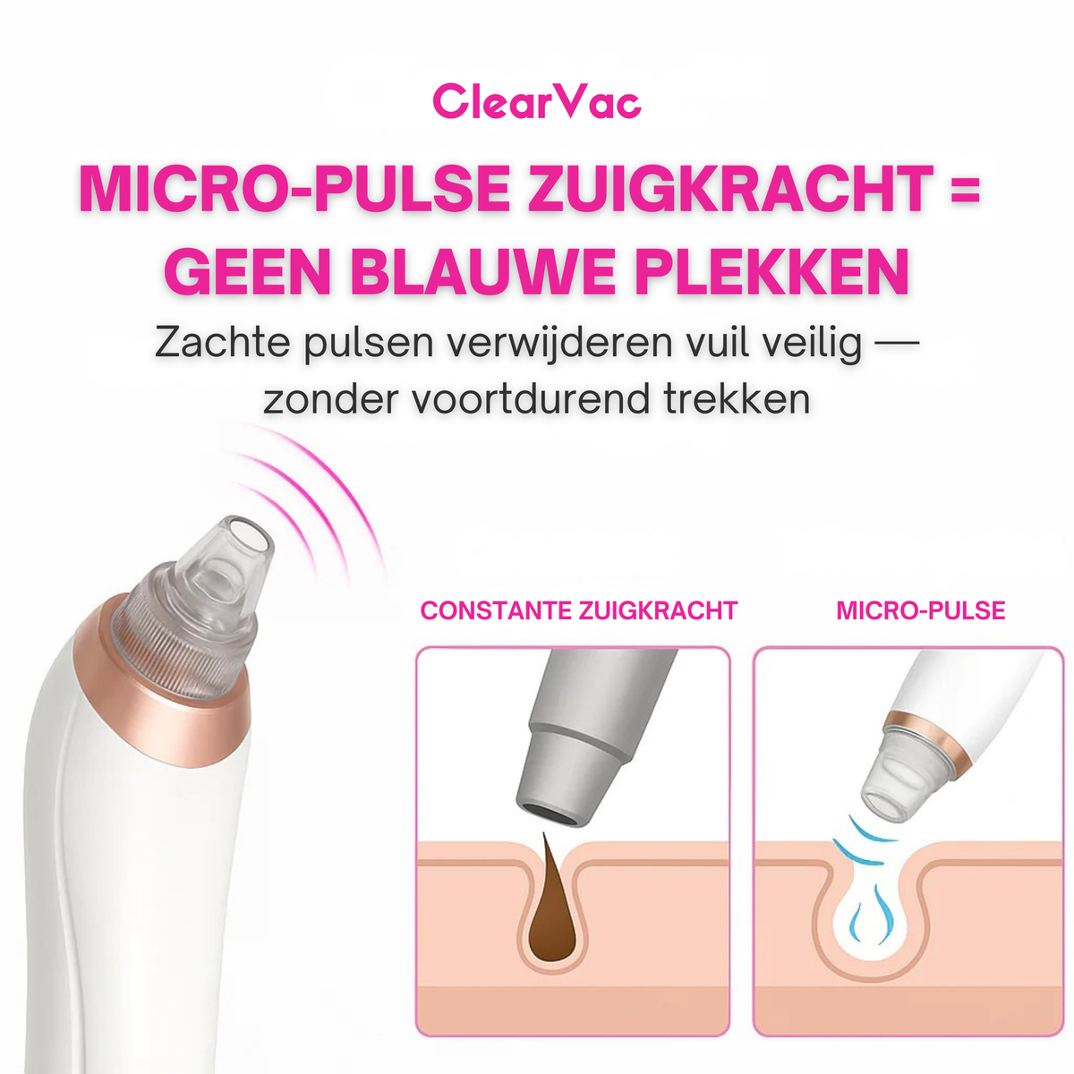 PoreLift | Makkelijk Mee-Eters Verwijderen