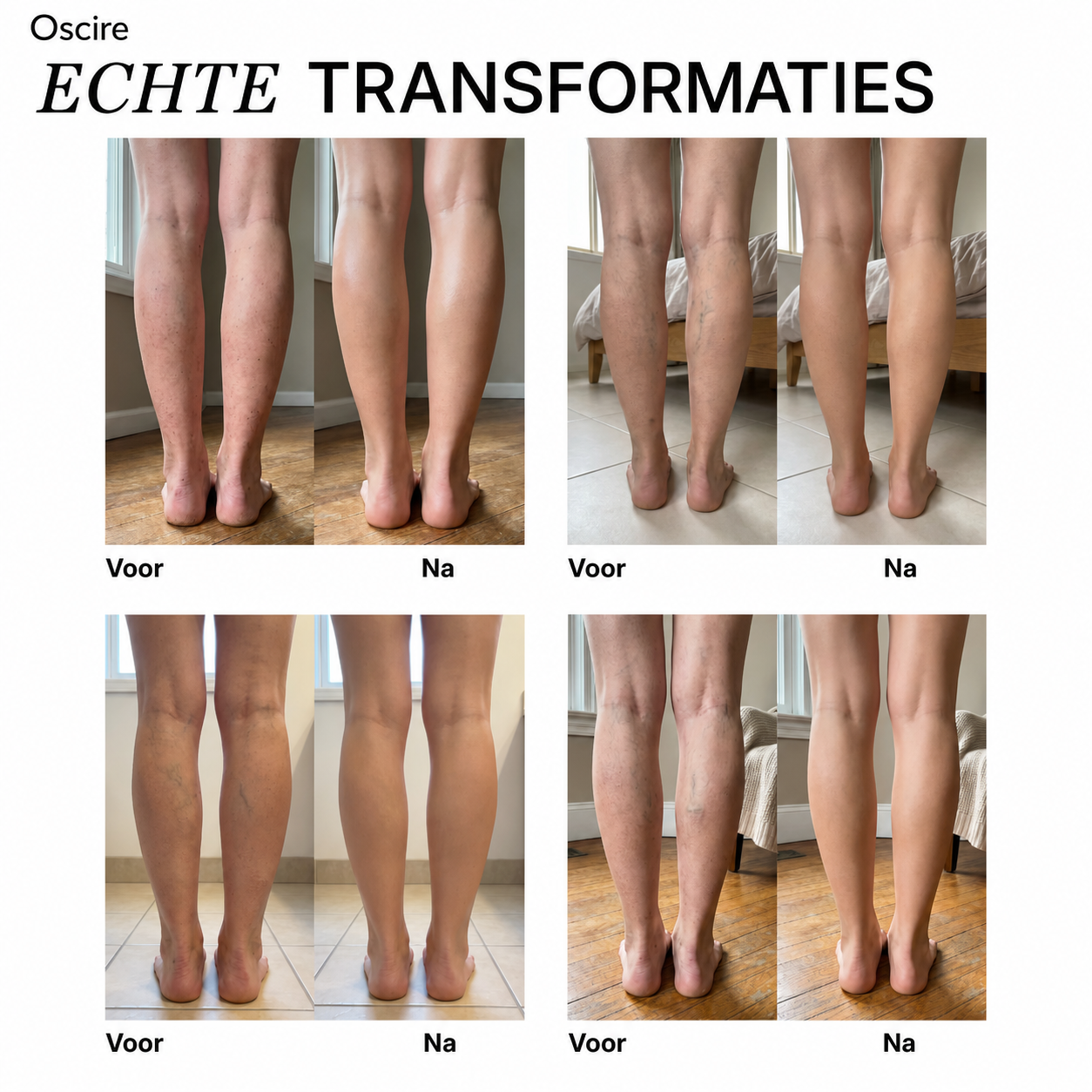 Been Makeup | Gelijkmatige dekking voor egale en stralende benen