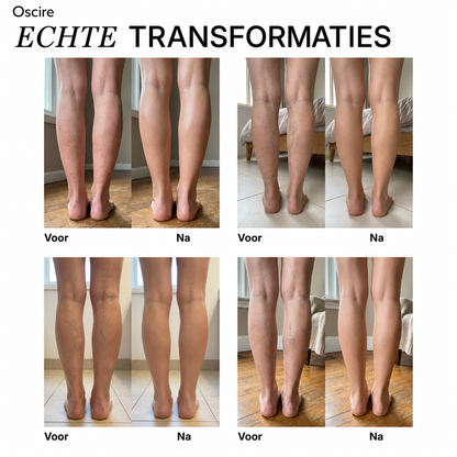 Been Makeup | Gelijkmatige dekking voor egale en stralende benen