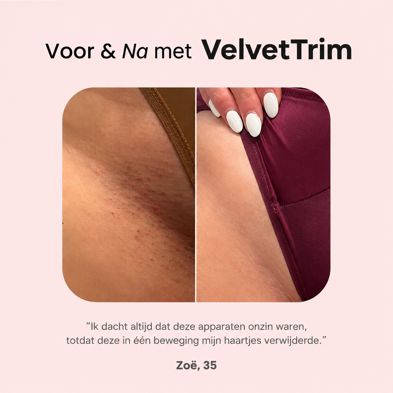 VelvetTrim | Bikini-shaver met precisiekop