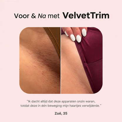 VelvetTrim | Bikini-shaver met precisiekop