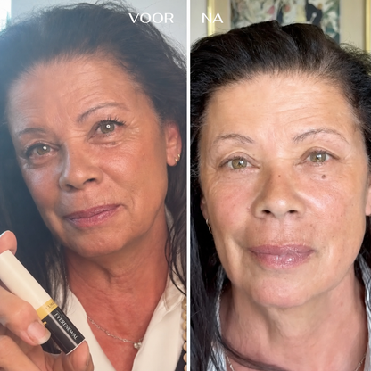 EyeRenewal | Verstevigende oogbalsem