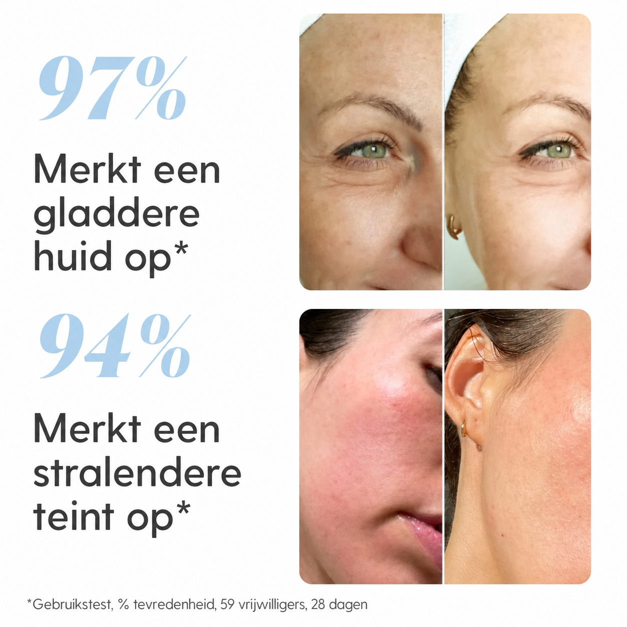 SkinGlow | Reinigend gezichtsapparaat 5-in-1