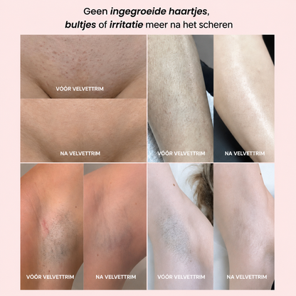 VelvetTrim | Bikini-shaver met precisiekop