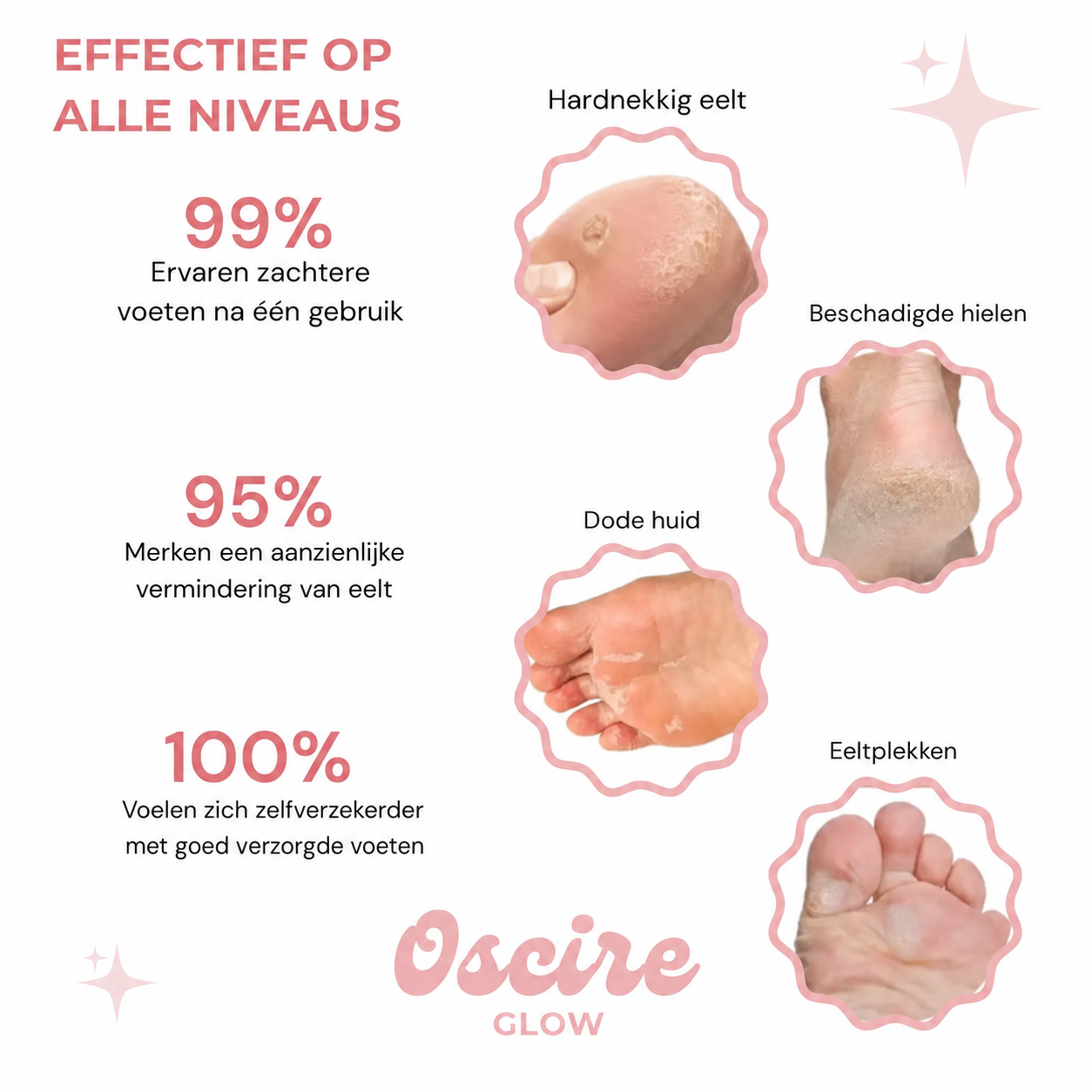 BabyClear | Krijg babyvoeten binnen 10 minuten