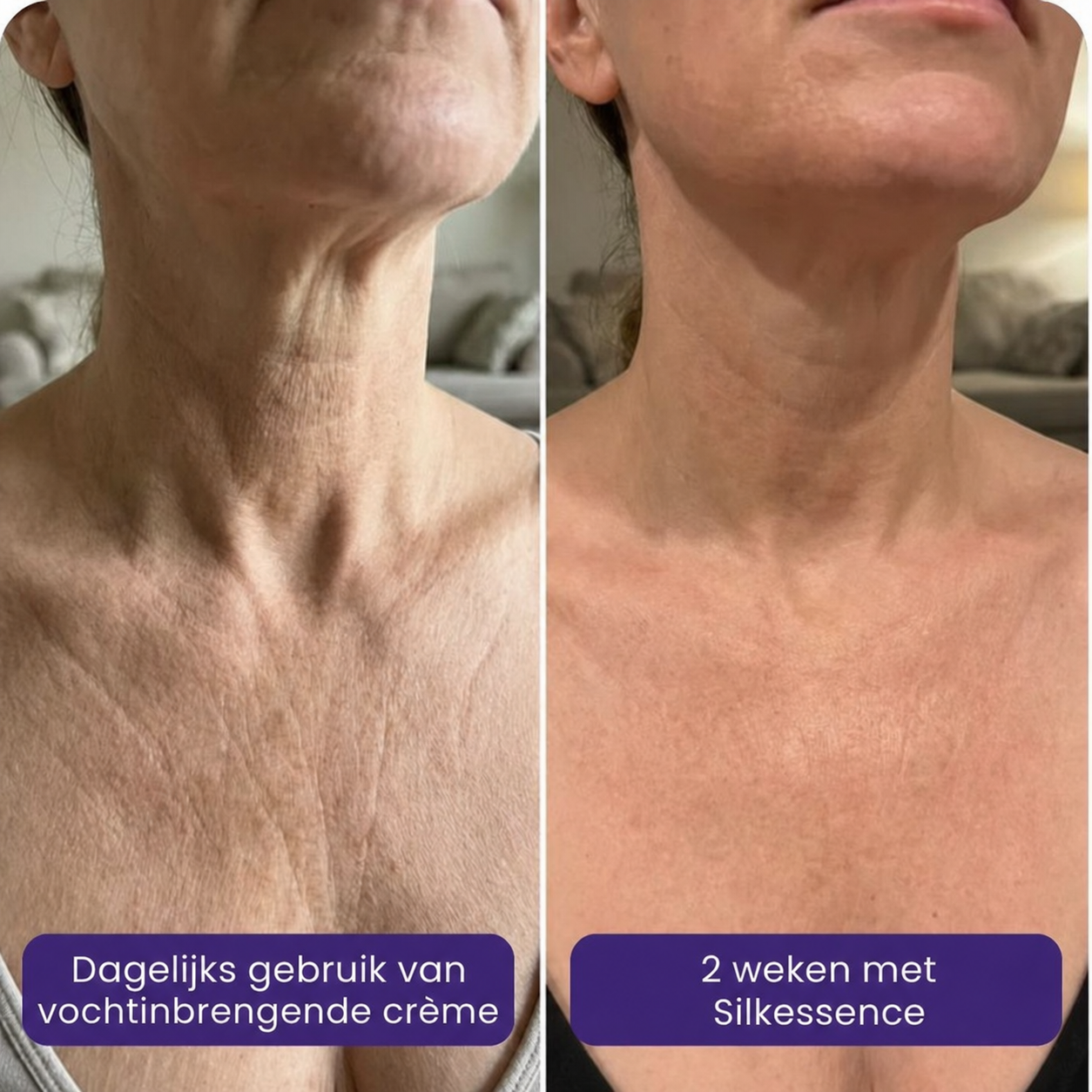 Silkessence | Hydrateert de huid langdurig en maakt deze soepel