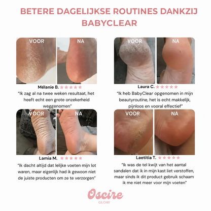 BabyClear | Krijg babyvoeten binnen 10 minuten
