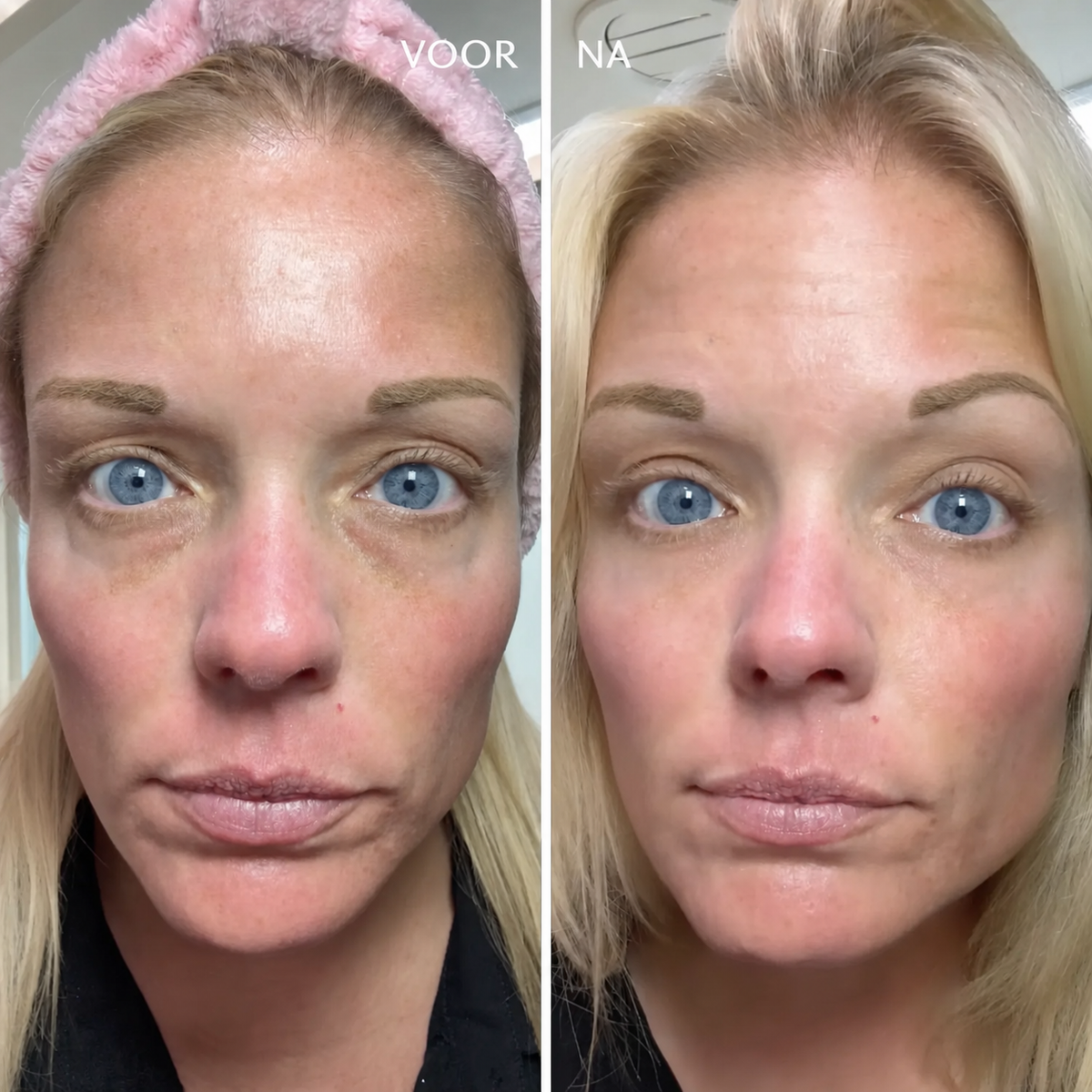EyeRenewal | Verstevigende oogbalsem