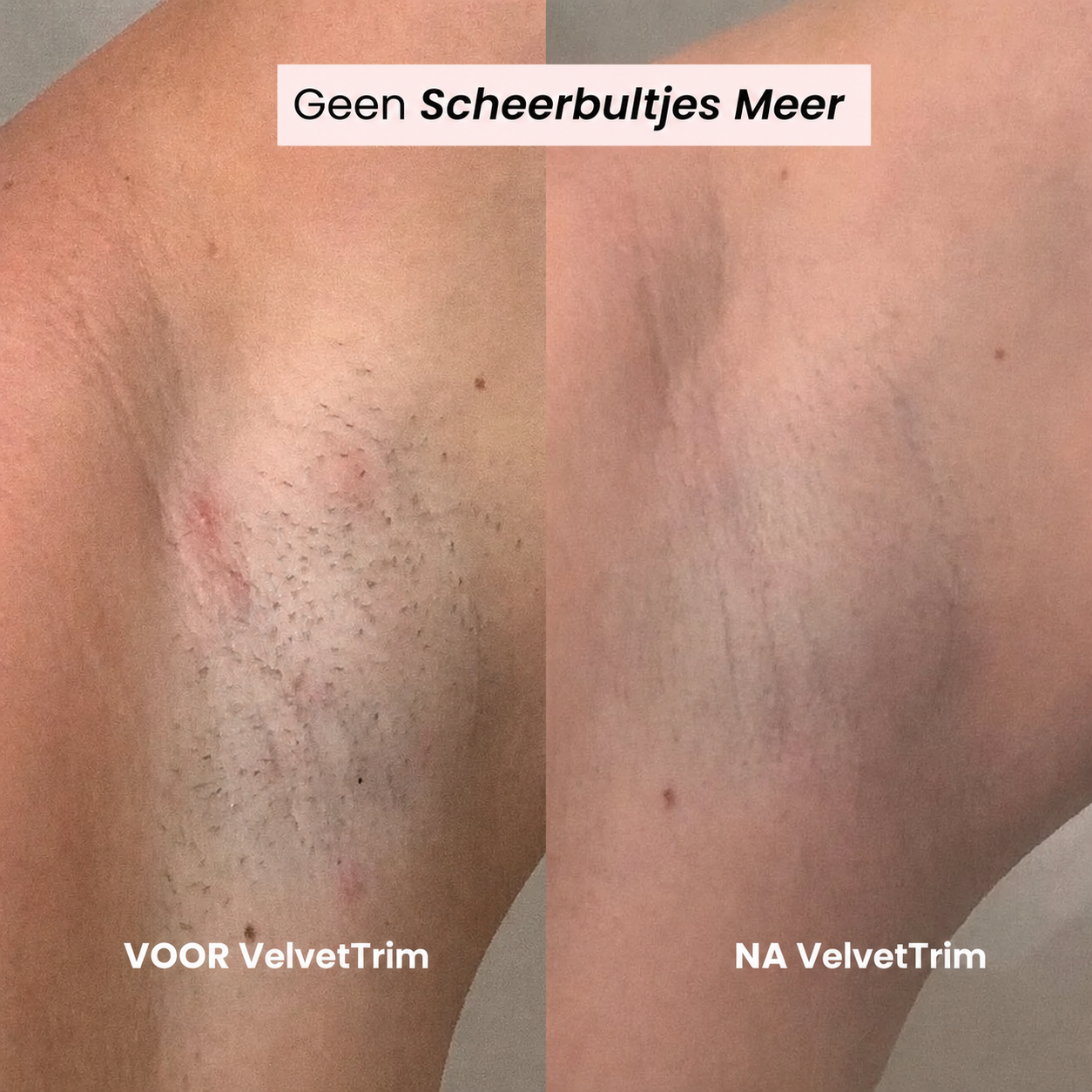 VelvetTrim | Bikini-shaver met precisiekop