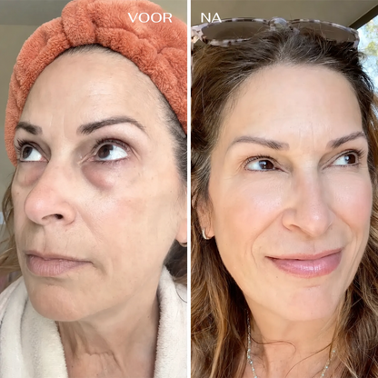EyeRenewal | Verstevigende oogbalsem