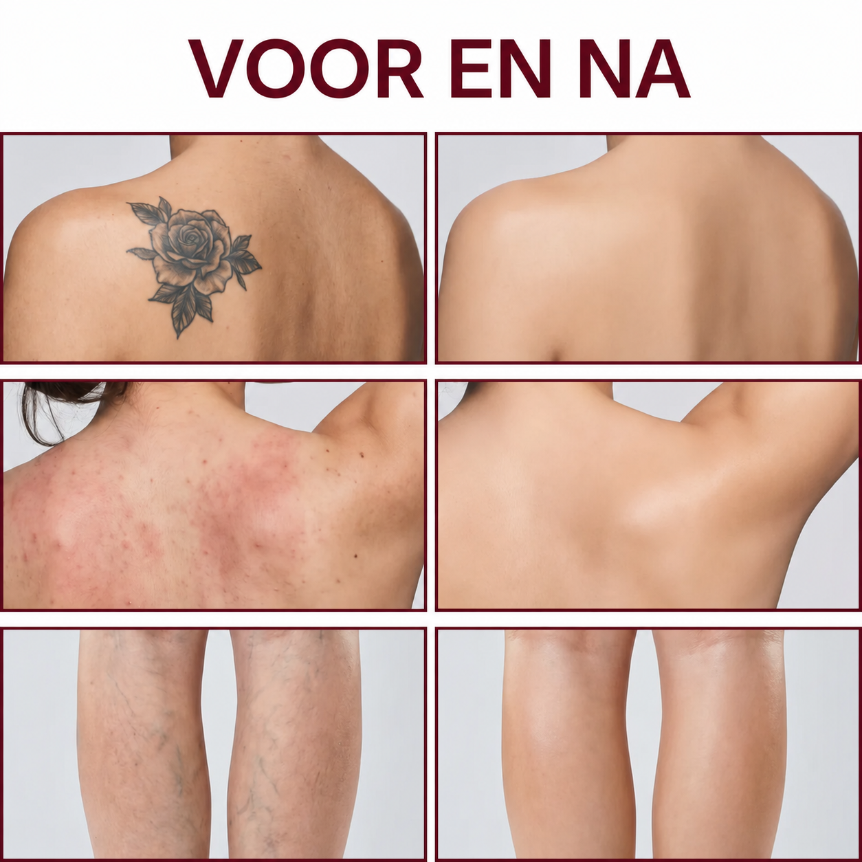 Been Makeup | Gelijkmatige dekking voor egale en stralende benen