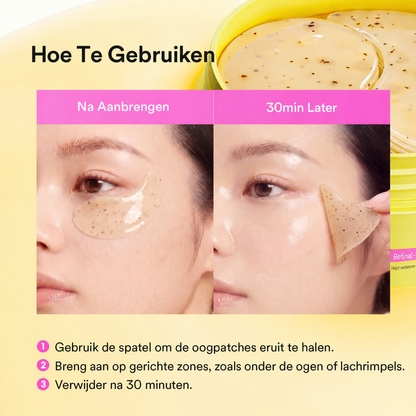 EyeRevive | Serum-to-gel oogpatches