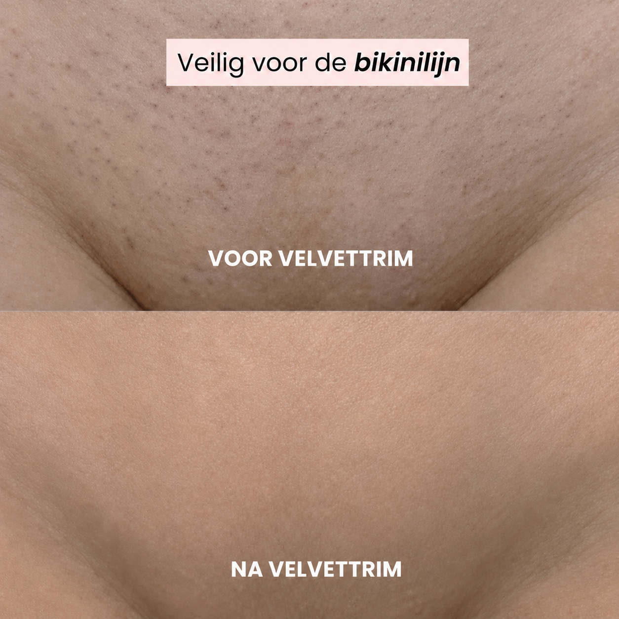VelvetTrim | Bikini-shaver met precisiekop