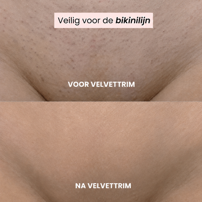 VelvetTrim | Bikini-shaver met precisiekop