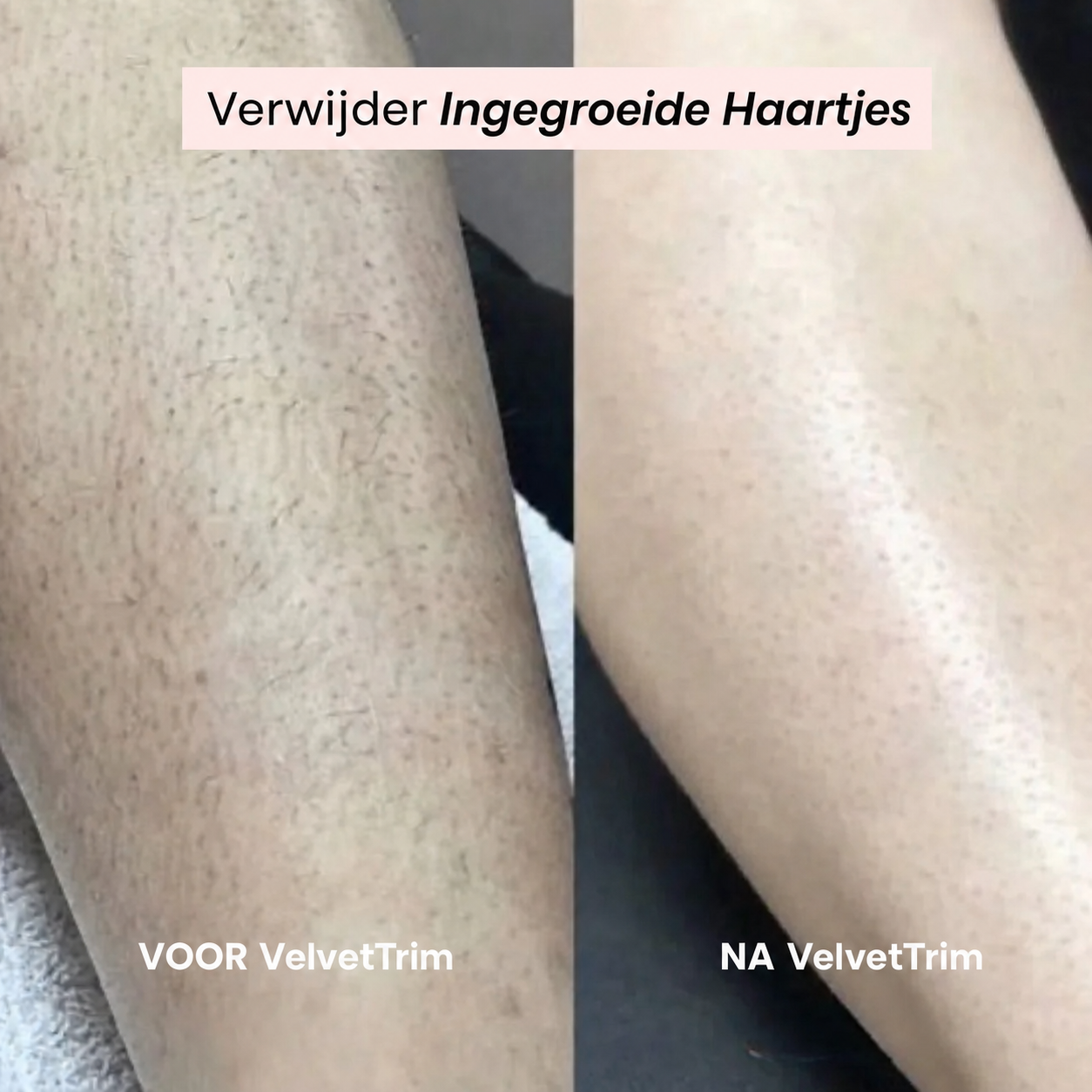 VelvetTrim | Bikini-shaver met precisiekop