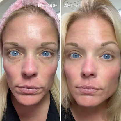 EyeRenewal | Verstevigende oogbalsem