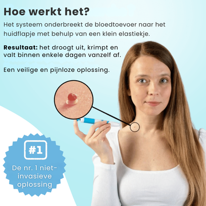 DermaSeal Thuisbehandelkit – Voor het Veilig Verwijderen van Huidflapjes