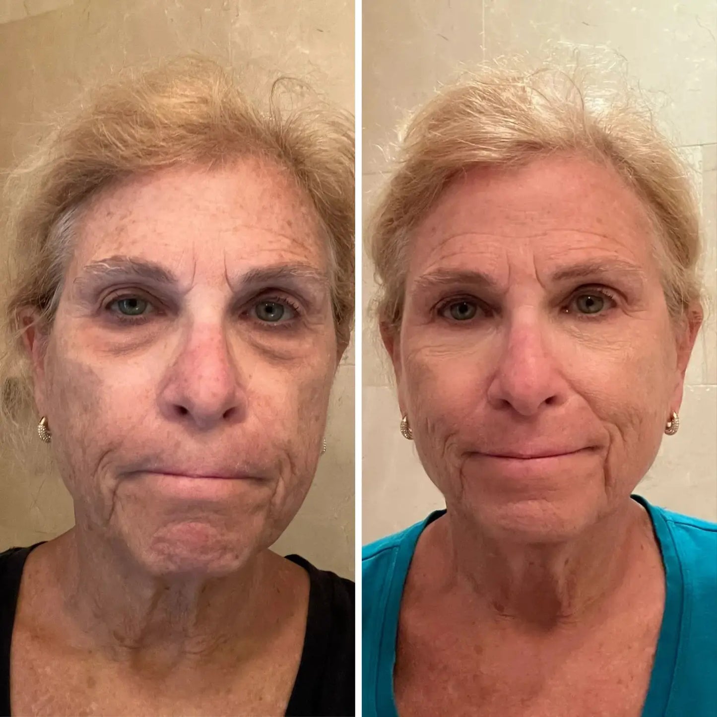 EyeRenewal | Verstevigende oogbalsem