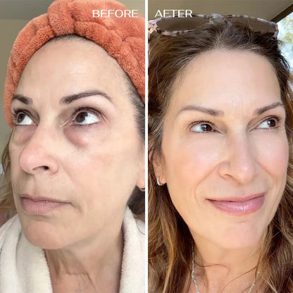 EyeRenewal | Verstevigende oogbalsem