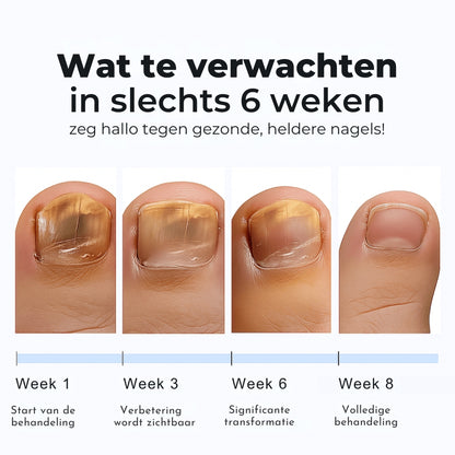 FungGone | Nagelherstelpleisters